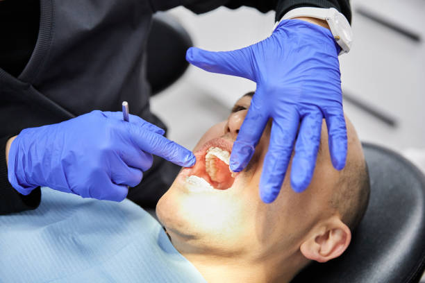 Best Emergency Root Canal Treatment in Falconer, NY